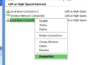 Local area network connections